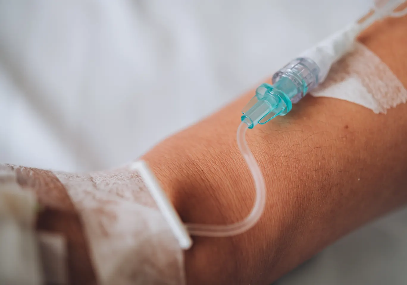 Kroplówki witaminowe Pleszew: wenflon oklejony na przedramieniu podczas wlewu